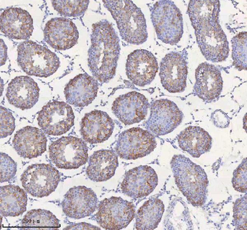 STIM1 Antibody