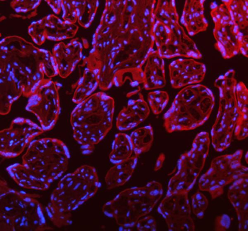 STIM1 Antibody