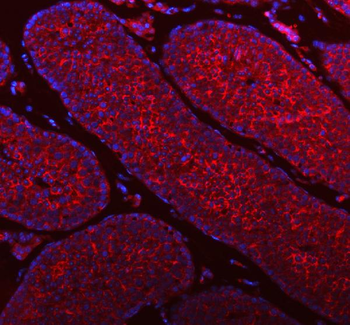 STIM1 Antibody