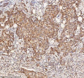 STIM1 Antibody