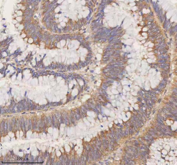 STIM1 Antibody