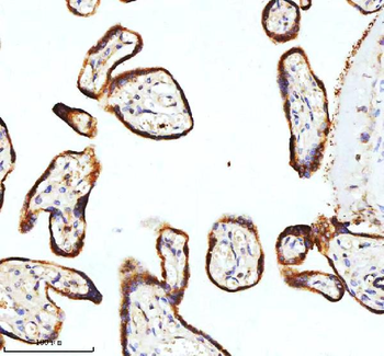 STIM1 Antibody
