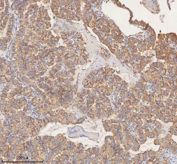 STIM1 Antibody