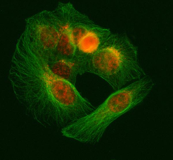 SNRNP70 Rabbit Polyclonal Antibody