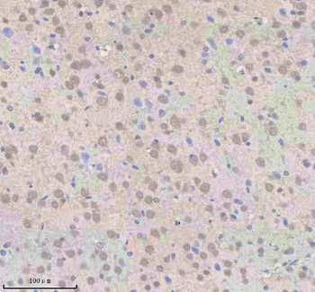 SNRNP70 Rabbit Polyclonal Antibody