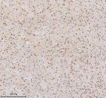 SNRNP70 Rabbit Polyclonal Antibody