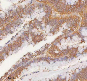 SLK Antibody