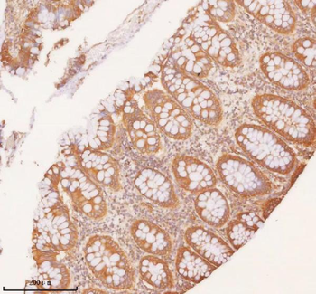 SLK Antibody