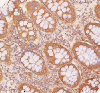 SLK Antibody