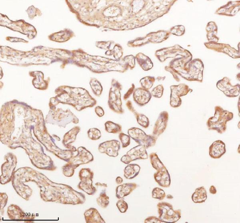 SLK Antibody