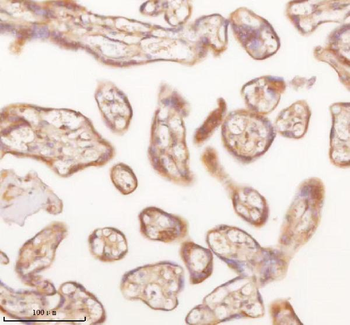 SLK Antibody