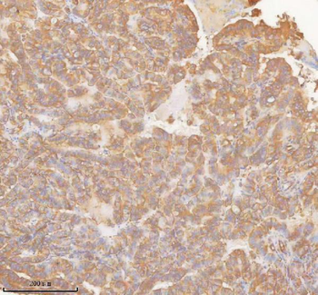 SLK Antibody