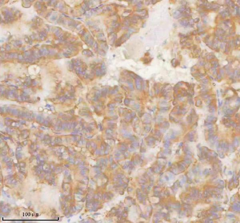 SLK Antibody