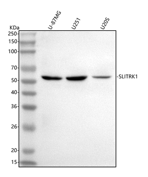SLITRK1 Rabbit Polyclonal Antibody