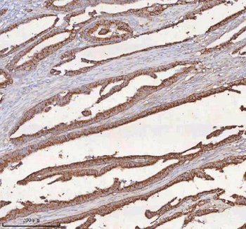 SLC6A20 Antibody