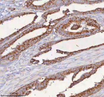 SLC6A20 Antibody