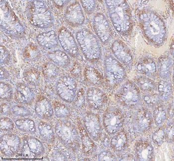 SLC6A20 Antibody