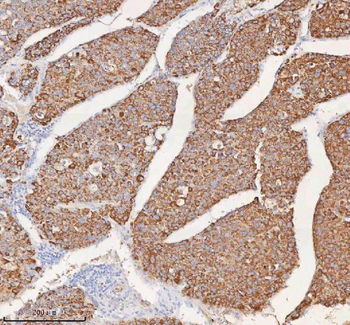 SLC6A20 Antibody