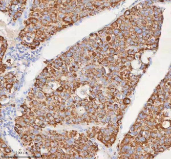 SLC6A20 Antibody