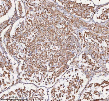 SLC6A20 Antibody