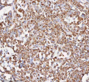 SLC6A20 Antibody