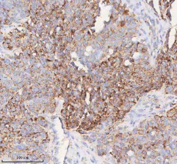 SLC6A20 Antibody