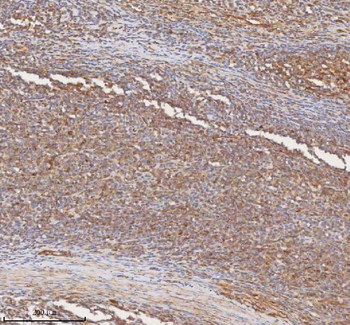 SHKBP1 Antibody