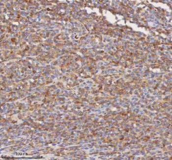SHKBP1 Antibody