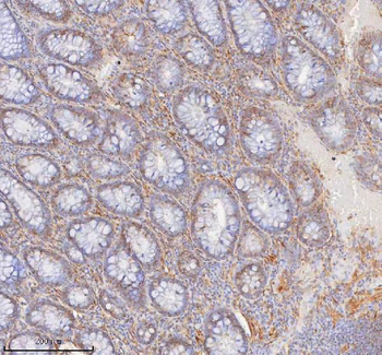 SHKBP1 Antibody