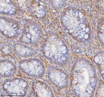 SHKBP1 Antibody