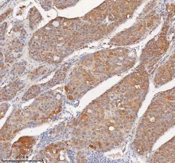 SHKBP1 Antibody