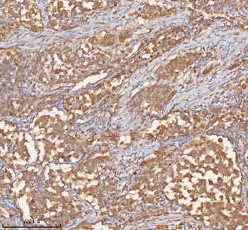 SHKBP1 Antibody