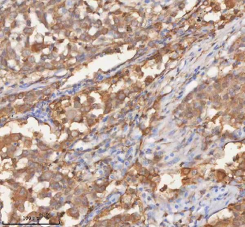 SHKBP1 Antibody