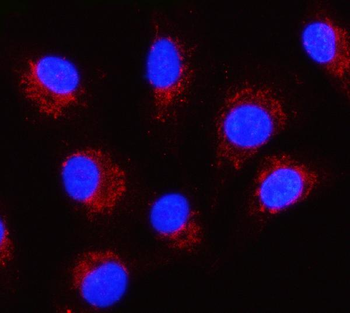SERPINB8 Antibody