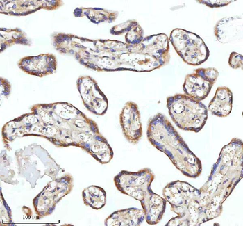 MIPEP Rabbit Polyclonal Antibody