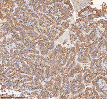 MIPEP Rabbit Polyclonal Antibody