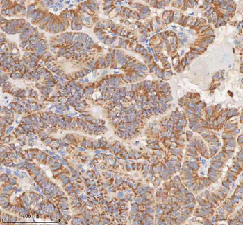 MIPEP Rabbit Polyclonal Antibody