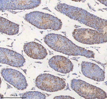 MIPEP Rabbit Polyclonal Antibody
