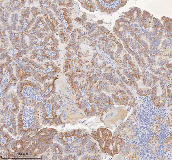 MINDY4 Rabbit Polyclonal Antibody