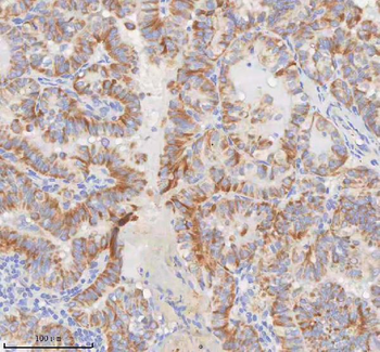 MINDY4 Rabbit Polyclonal Antibody