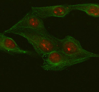 METTL18 Antibody