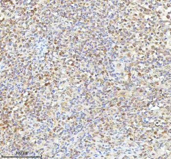 METTL18 Antibody