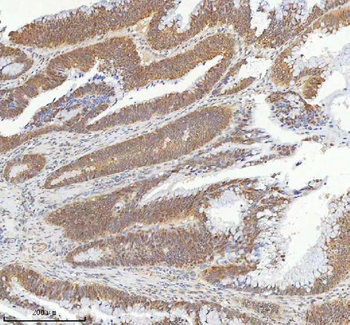 METTL18 Antibody
