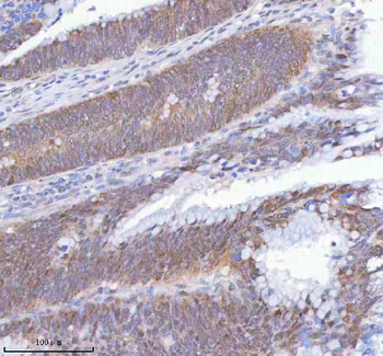 METTL18 Antibody