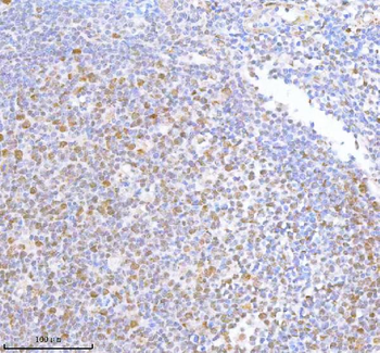 METTL18 Antibody