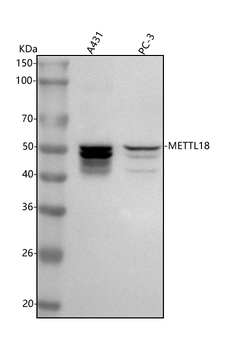 METTL18 Antibody
