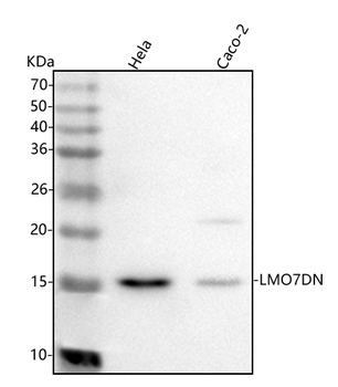 LMO7DN Rabbit Polyclonal Antibody
