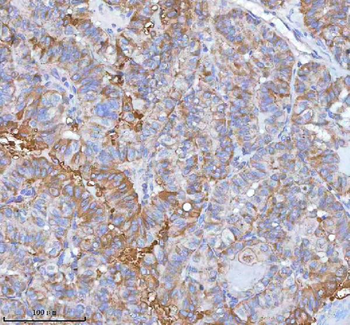 hIST1/IST1 Antibody