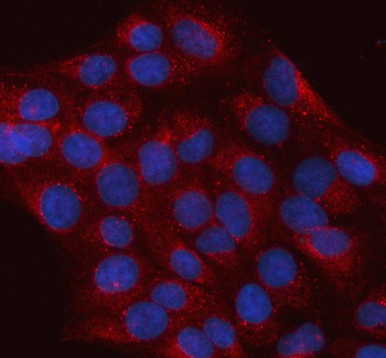 hIST1/IST1 Antibody