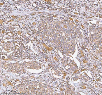 hIST1/IST1 Antibody